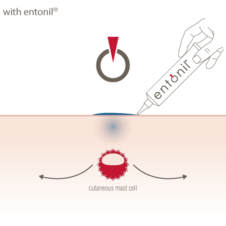 Effect with Entonil